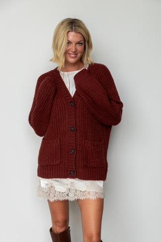 The Colette Lace Mini Dress